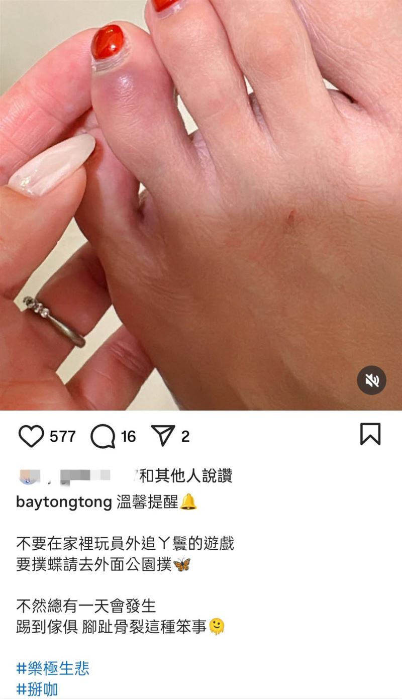 貝童彤透露骨裂原因。（圖／翻攝自貝童彤IG）