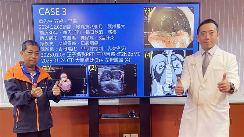 58歲男喉嚨痛看不好！一檢查竟4癌纏身