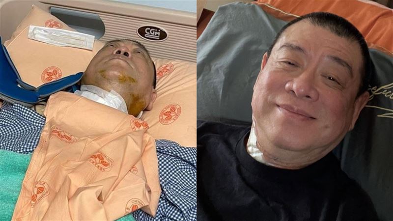 孫德榮傳借出5千萬討不回 才爆住院插管