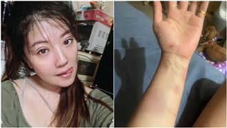 女星撞警遭逮！氣炸反擊：我的傷勢更嚴重