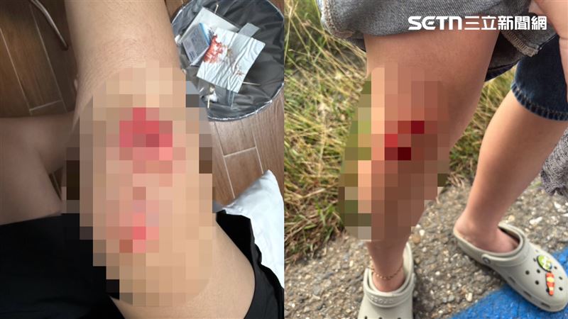 爆胎摔車,導致2人手、腳甚至臉部有擦傷挫傷。(圖/讀者提供)