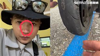 獨／車輪磨光…繼續租？害女遊客慘摔破相