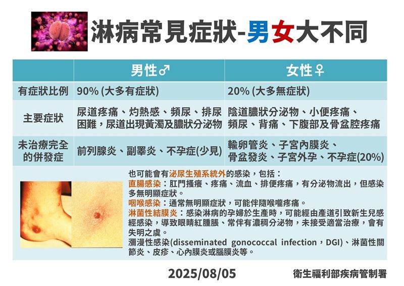 淋病常見症狀-男女大不同。(圖/疾管署提供)