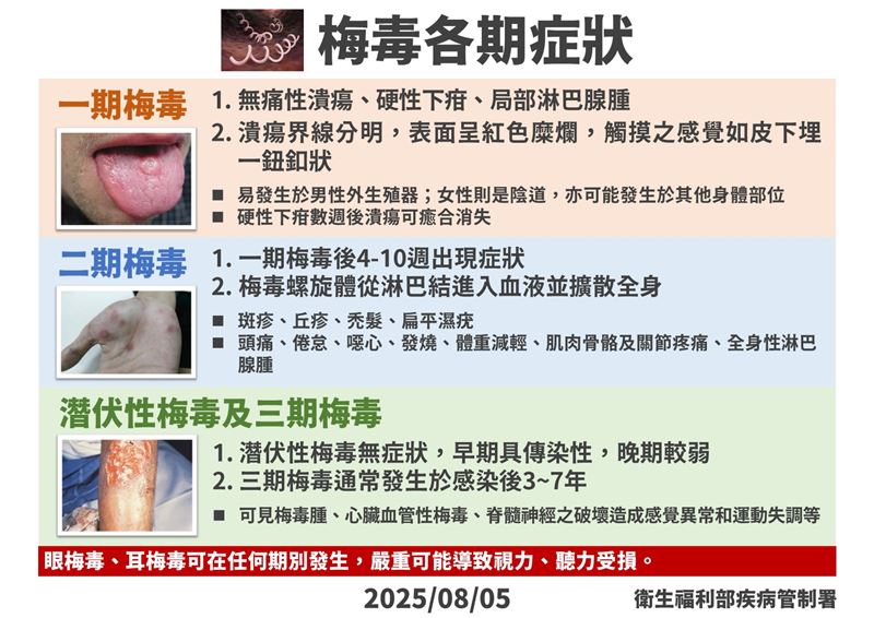 梅毒各期症狀。(圖/疾管署提供)