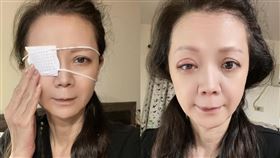 高欣欣把藥水點進眼睛，結果眼睛紅腫灼傷。（圖／翻攝自臉書）