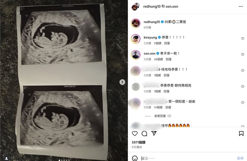 高爾宣愛妻芮德喜曬超音波照。(圖/翻攝自IG)