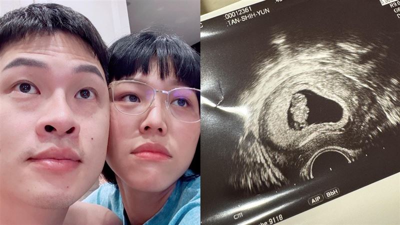 楊昇達曬出超音波照片。（圖／翻攝自臉書）