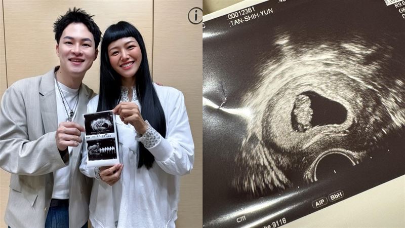 男星宣布當爸!愛妻見兩條線激動噴淚