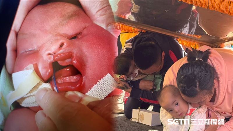 獨／不捨唇腭裂寶寶　媽祖鑾轎突倒退賜福
