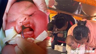 獨／不捨唇腭裂寶寶　媽祖鑾轎突倒退賜福