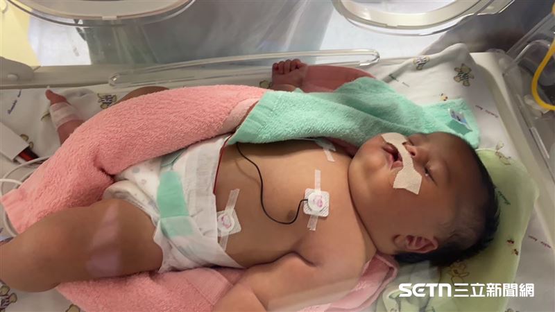 小乖乖不只唇腭裂，左眼瞼也無法完全閉合，出生後住在保溫箱裡，爸爸不斷地為他加油，媽媽則努力學習照顧她的方式。（圖／受訪者提供）