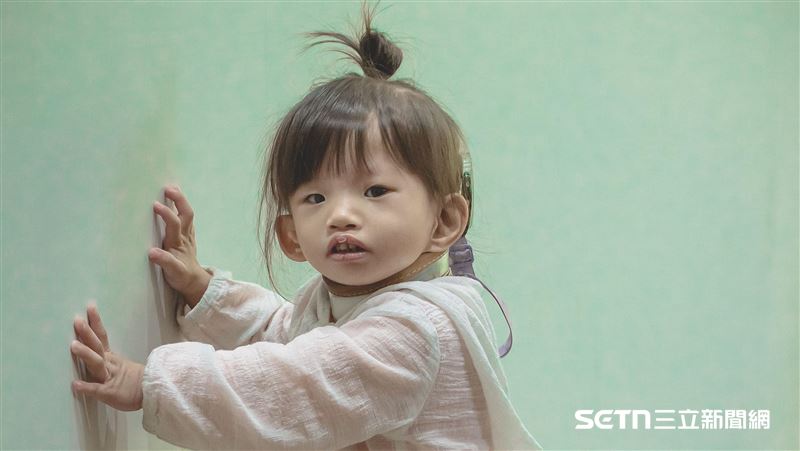 獨／女兒生下畸形兒　她曝天機阿嬤釋懷了