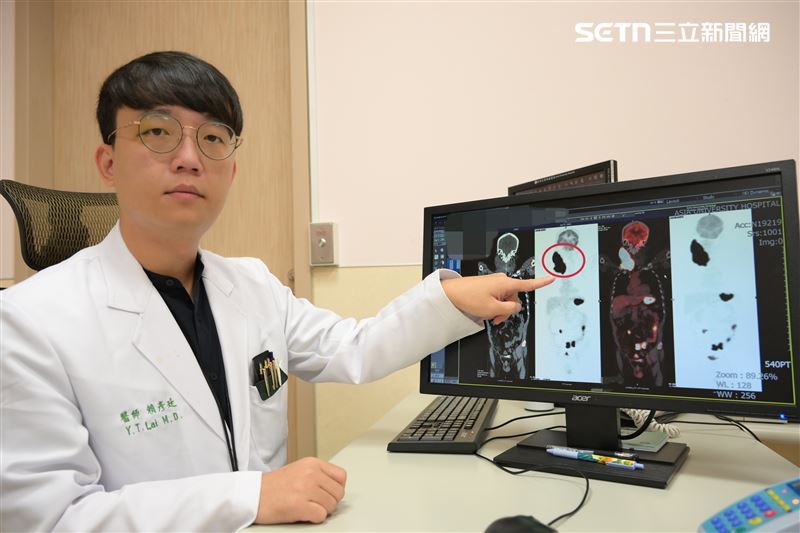 經安排影像檢查,患者罹患「伯基特淋巴瘤」腫瘤與氣管僅僅相隔0.1公分,幾乎已經壓迫到呼吸道。。(圖/翻攝畫面)