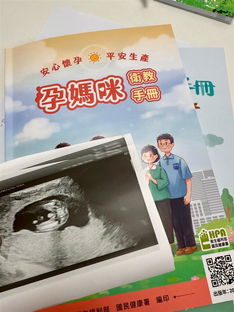 黃瀞瑩在粉專分享懷孕的超音波照。(圖/翻攝自黃瀞瑩粉專)