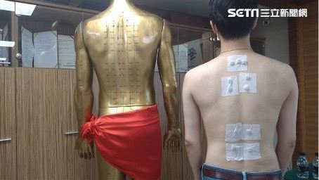 注意不是每個人都適合三伏貼。 (圖/三立新聞網)