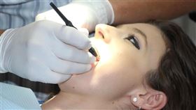 牙齒,看牙,牙醫。（示意圖／PIXABAY）