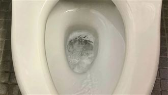 40歲女肛門癢翻！醫點元凶：濕紙巾害的