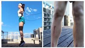 Uni-Girls成員冞冞跳繩弄傷自己。（圖／冞冞提供） 