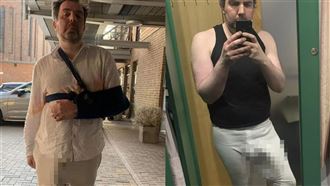 擁37公分世界最長命根子！男洗澡滑倒骨折