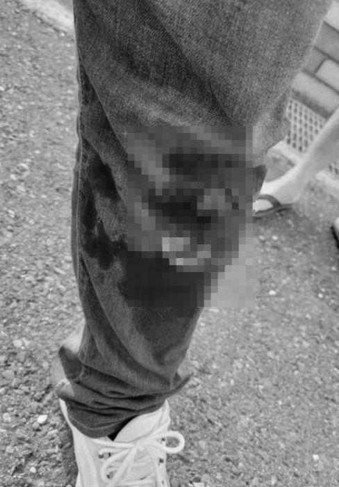 洪騰明左腿慘遭加納利犬撕咬，牛仔褲被咬穿，鮮血直流。（圖／翻攝畫面）