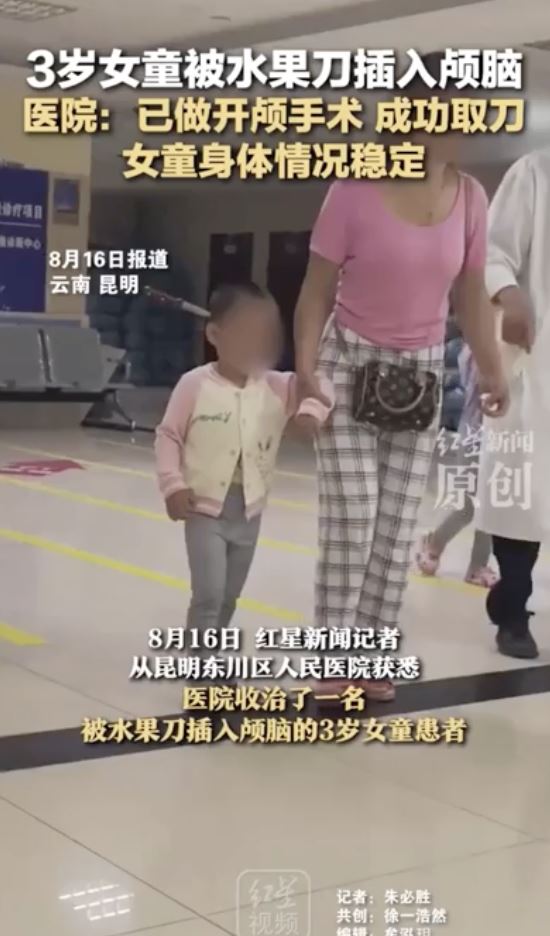 3歲女童腦袋插了把水果刀，淡定的到醫院急診。（圖／翻攝自微博）
