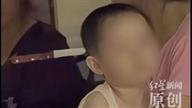 女童,水果刀,頭顱,手術（圖／翻攝自微博）