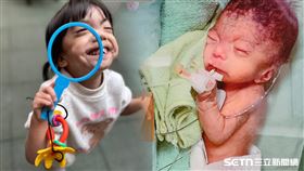 罕病女童宓宓／受訪者提供