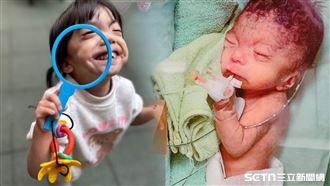 獨／帶罕病女兒出門　公園阿婆：不該救她