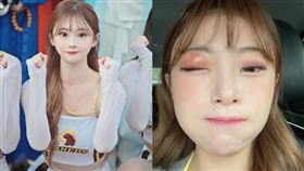 金娜妍得到帶狀皰疹。（圖／翻攝自Threads）