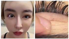 雪碧如今眼部出事（圖／翻攝自Thread @sprite0719ss）