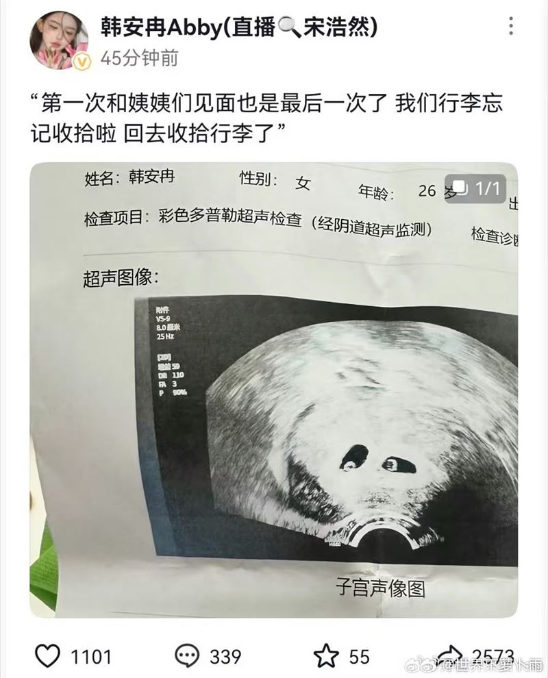 網友認為韓安冉曬出超音波照片很假，韓安冉如今已將其刪除。（圖／翻攝自微博）