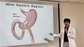 47歲女，減重手術鏟肉瘦23公斤，竟出現嚴重貧血併發症，血色素(圖／台中醫院)