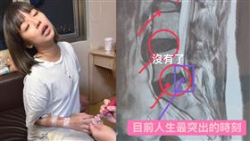 萁萁表示自己住院，病因是椎間盤突出。（圖／翻攝自臉書）