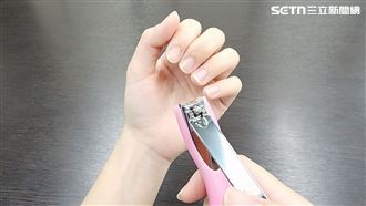 25歲妙齡女「走路如針扎」　竟因指甲惹禍