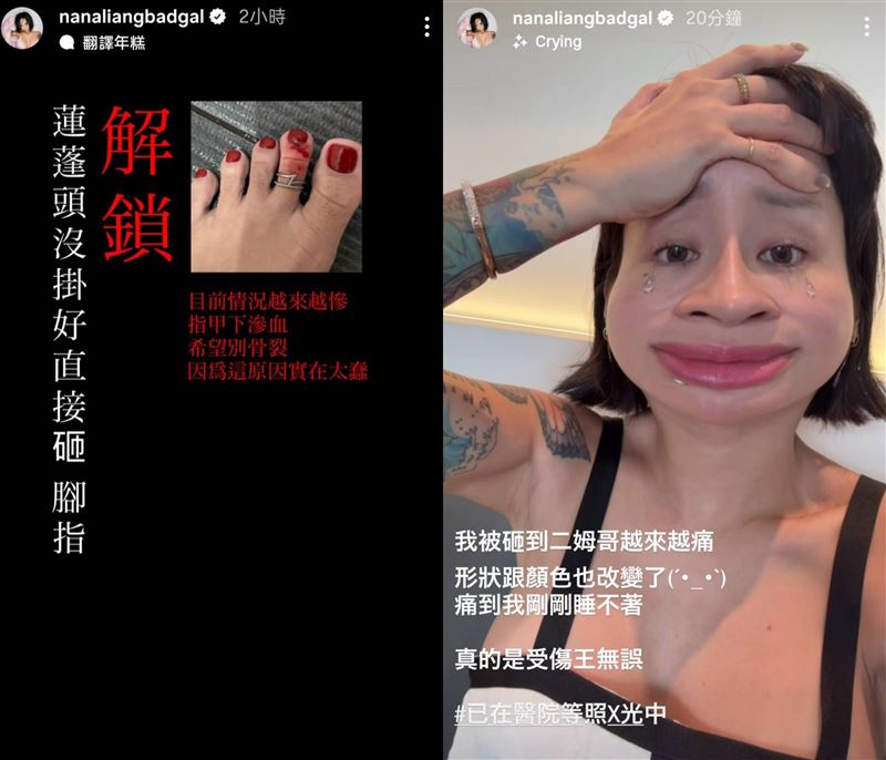 梁云菲遭到蓮蓬頭砸傷。（圖／翻攝自梁云菲IG）