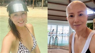 乳癌惡化擴散淋巴　51歲女星8次化療續命