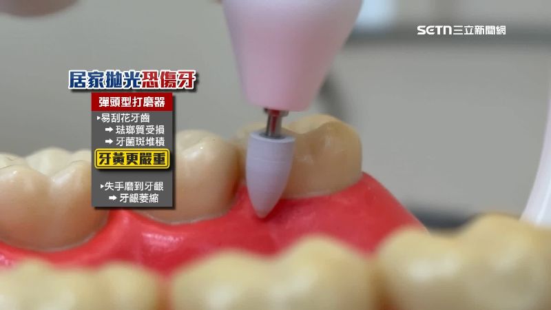 醫師提醒風險