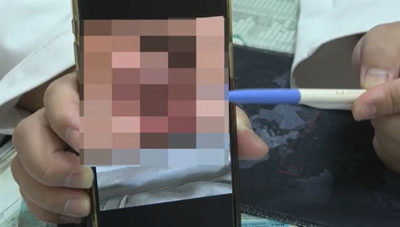 台中23歲男子,與7位女友發生性行為都沒戴保險套,包皮、龜頭潰爛變黑,陰莖有一半化膿流出血水。(圖/大甲李綜合醫院提供)