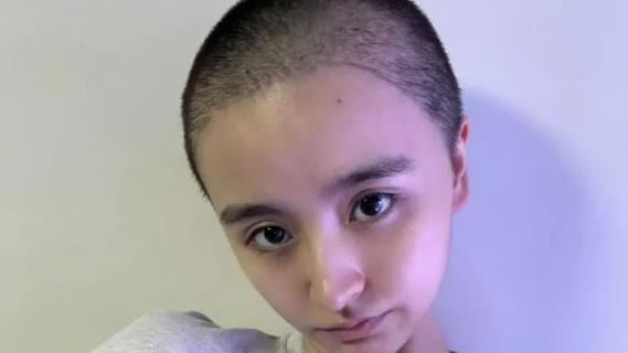 退演藝圈4個月　最美童星暴瘦光頭現身