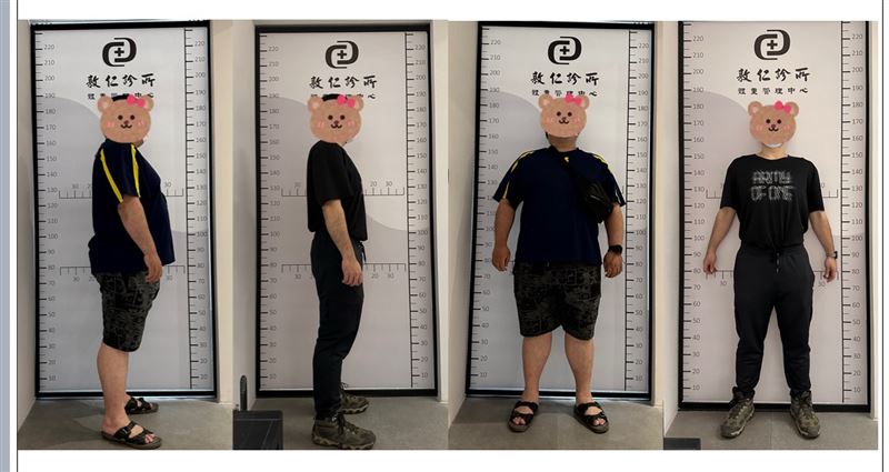 一名男性病患在治療後，體重從144公斤減至89公斤，恢復到正常標準。（圖／蕭敦仁醫師提供）