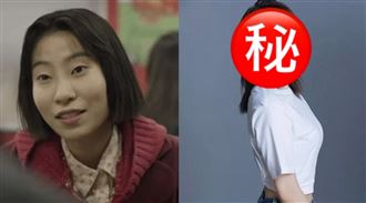 狠砸1億整形　女星爆隆乳失敗二度動刀