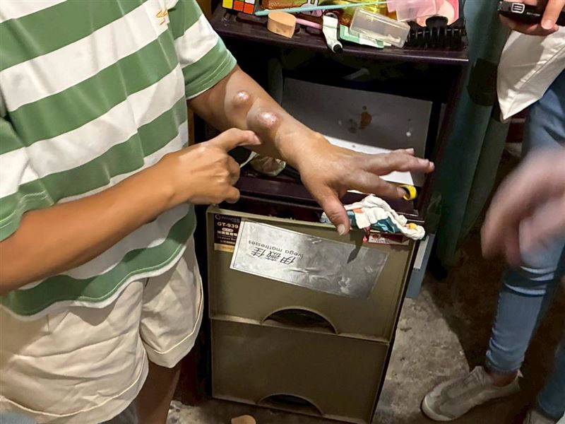 父親臥病、母親雙手變形、哥哥智能障礙，大四罕病女孩小婷拼獎學金養全家令人心疼。（圖／《愛的延續公益協會》提供）