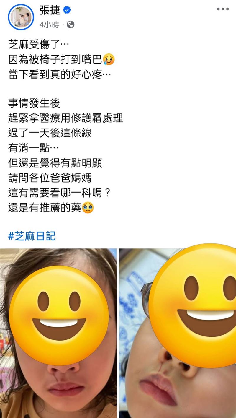 張捷透露女兒受傷。（圖／翻攝自張捷臉書）