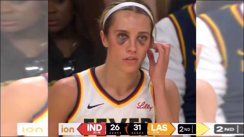 WNBA球員霍爾（Lexie Hull）頂著黑眼圈出賽引熱議。（圖／翻攝自Courtside Buzz X）