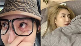 雪碧當初為了追求水汪汪的大眼效果，不顧醫生的警告堅持做提眼手術，導致雙眼無法完全閉合。（圖／翻攝自雪碧臉書）