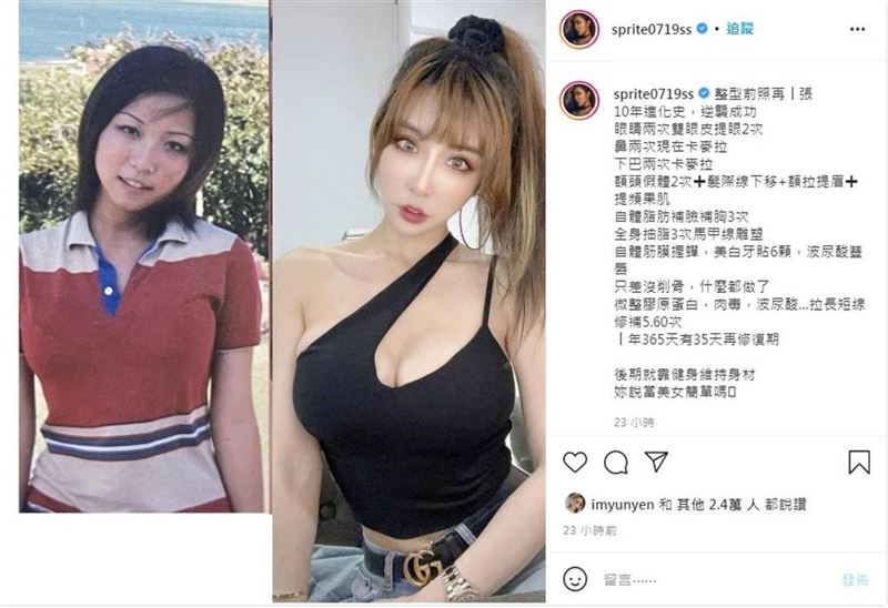 雪碧曾公開20多年前未整形的照片，讓網友看了驚呆：「也差太多了吧？」（圖／翻攝自雪碧IG）