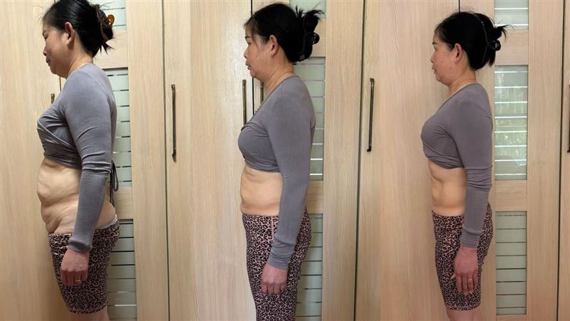 53歲婦「2個月狂甩8公斤」！前後對比照曝