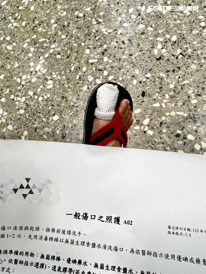 婦人穿著拖鞋去黃昏市場，結果慘遭老鼠咬