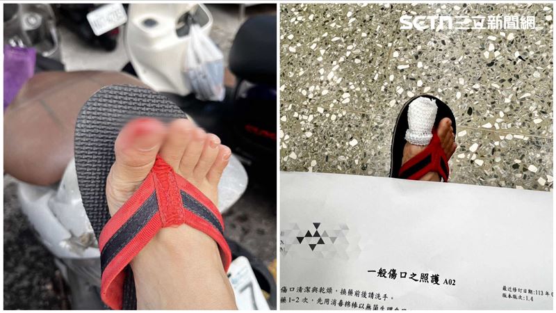 台南,老鼠,婦人,拖鞋,破傷風針,工作