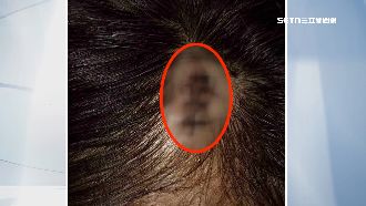 獨／什錦麵老店闆遭毆　控隔壁攤眼紅動手